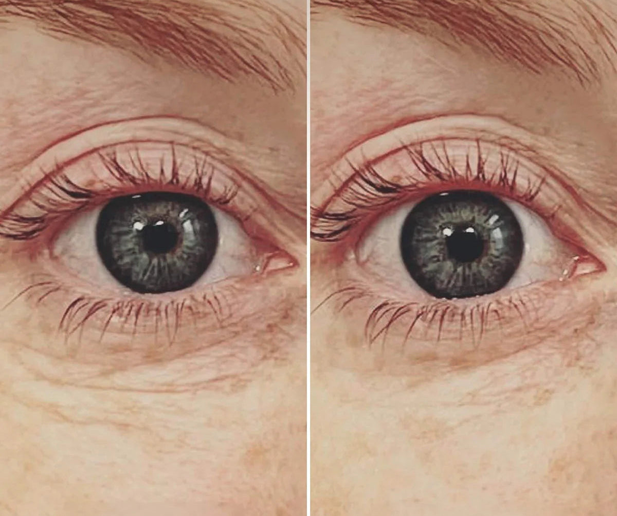 2 Patchs hydratant yeux à l'acide hyaluronique réutilisable