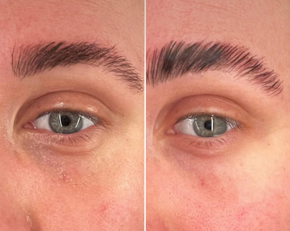 2 Patchs illuminant yeux à la vitamine C réutilisable